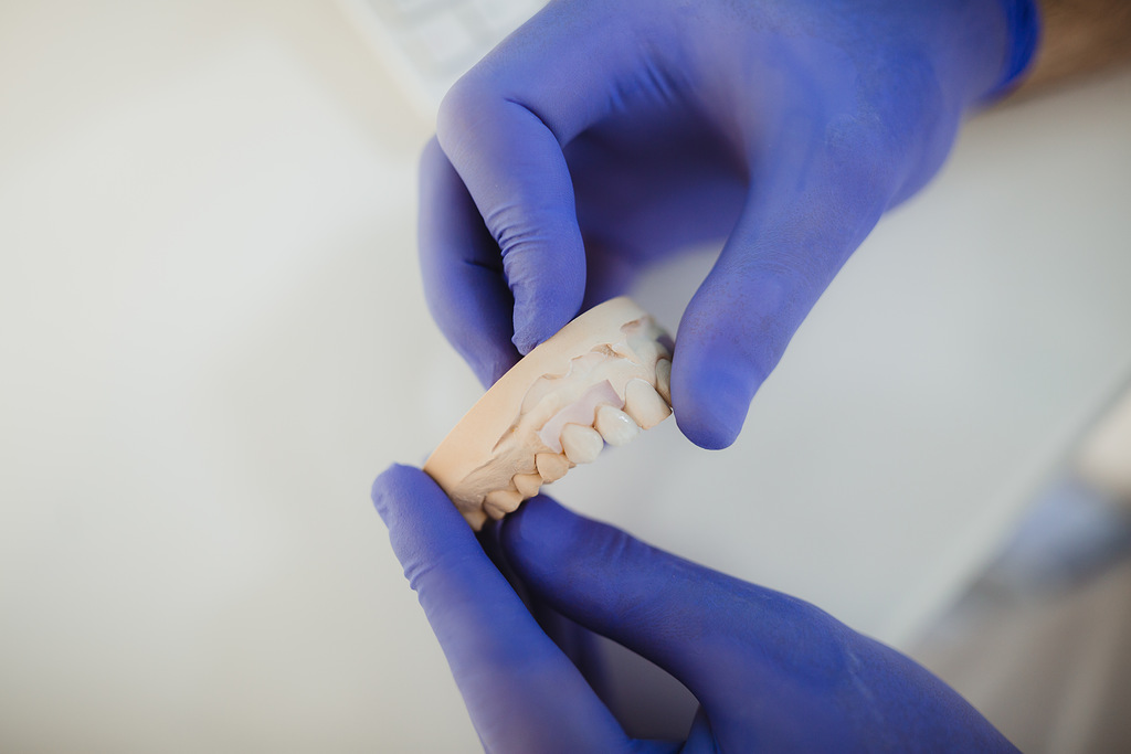 Микропротезирование вкладками