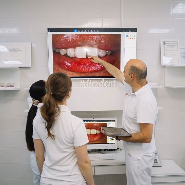 Виниры и люминиры